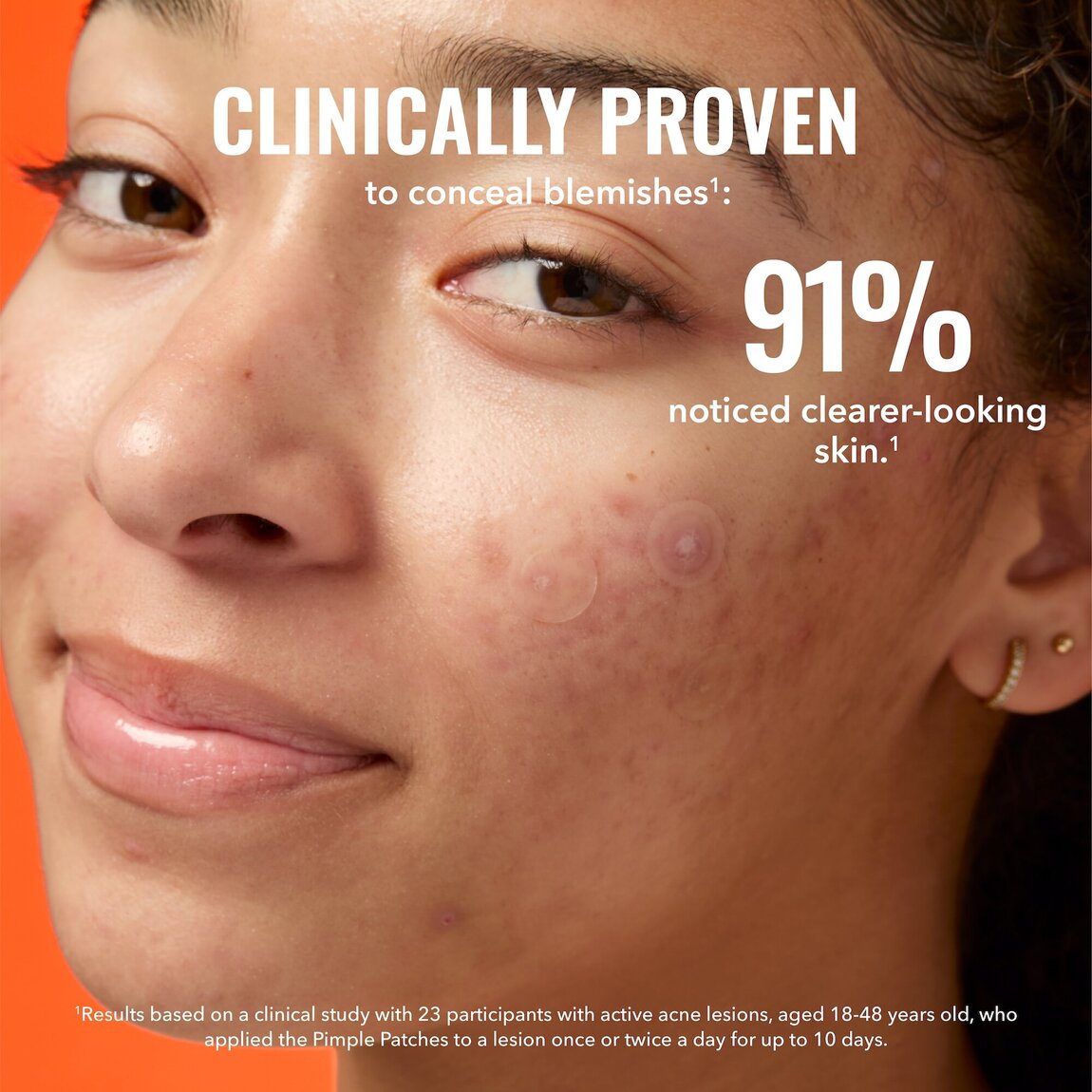 pimple-patches-y8 zb_p.jpg
