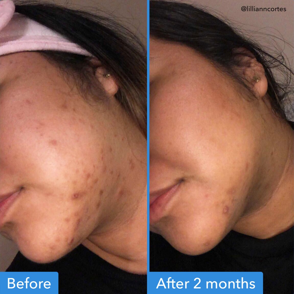 discoloration-correcting-serum-g2 zb_p.jpg