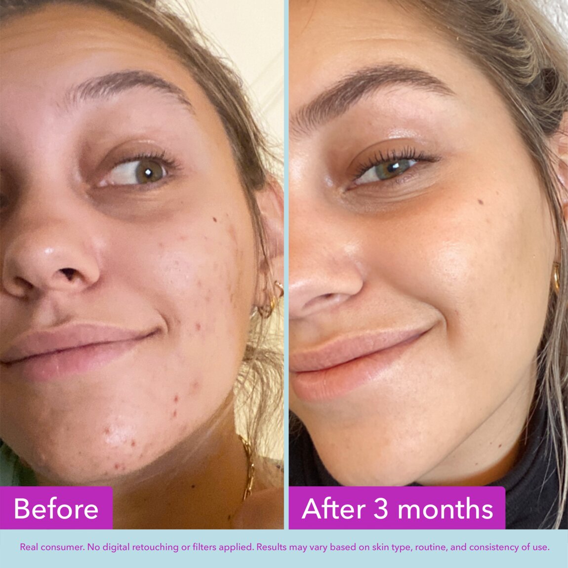 niacinamide-brightening-toner-n1 zb_p.jpg